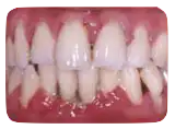 picture of a mouth