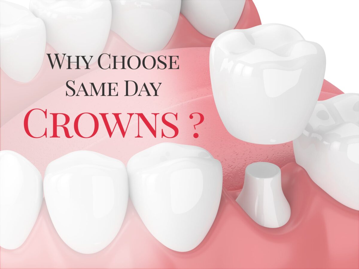 Why You Deserve a Beautiful Smile Sooner Rather Than Later With Same Day Crowns