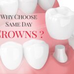 Why You Deserve a Beautiful Smile Sooner Rather Than Later With Same Day Crowns