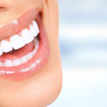 What Are the Pros and Cons of Teeth Whitening?