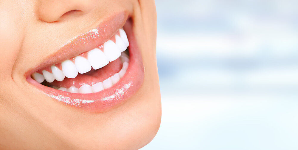 dental teeth whitening