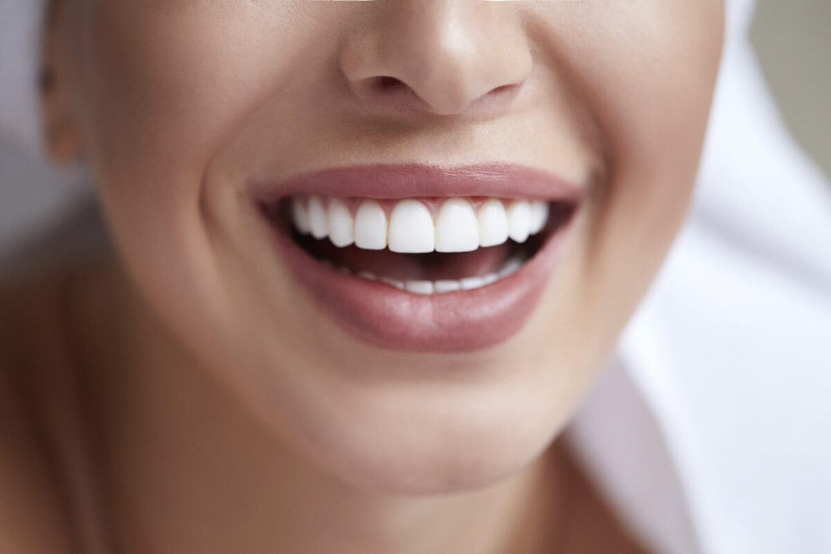 Composite Veneers vs Porcelain Veneers: Which Is the Best Choice For You? |  Arrow Smile Dental