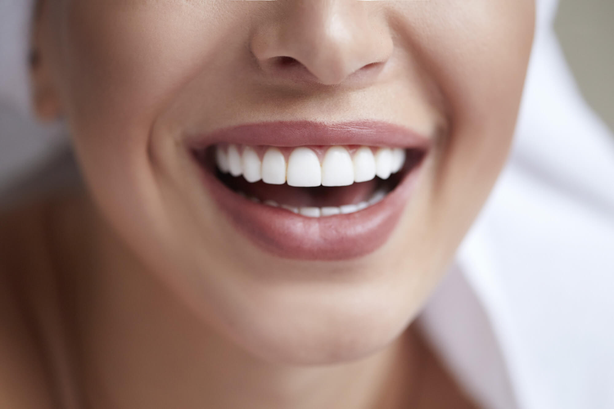 porcelain veneers