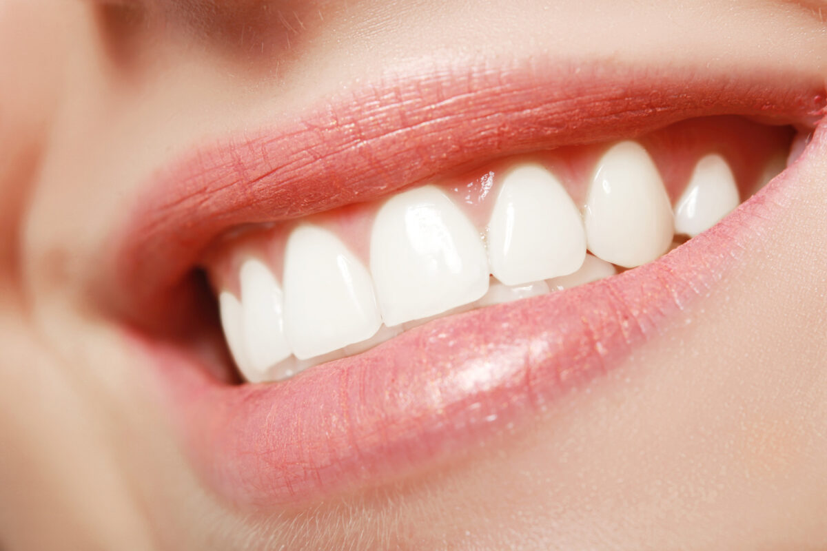 5 Cosmetic Dentistry Procedures to Dramatically Improve Your Smile | Arrow Smile  Dental