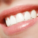 5 Cosmetic Dentistry Procedures to Dramatically Improve Your Smile