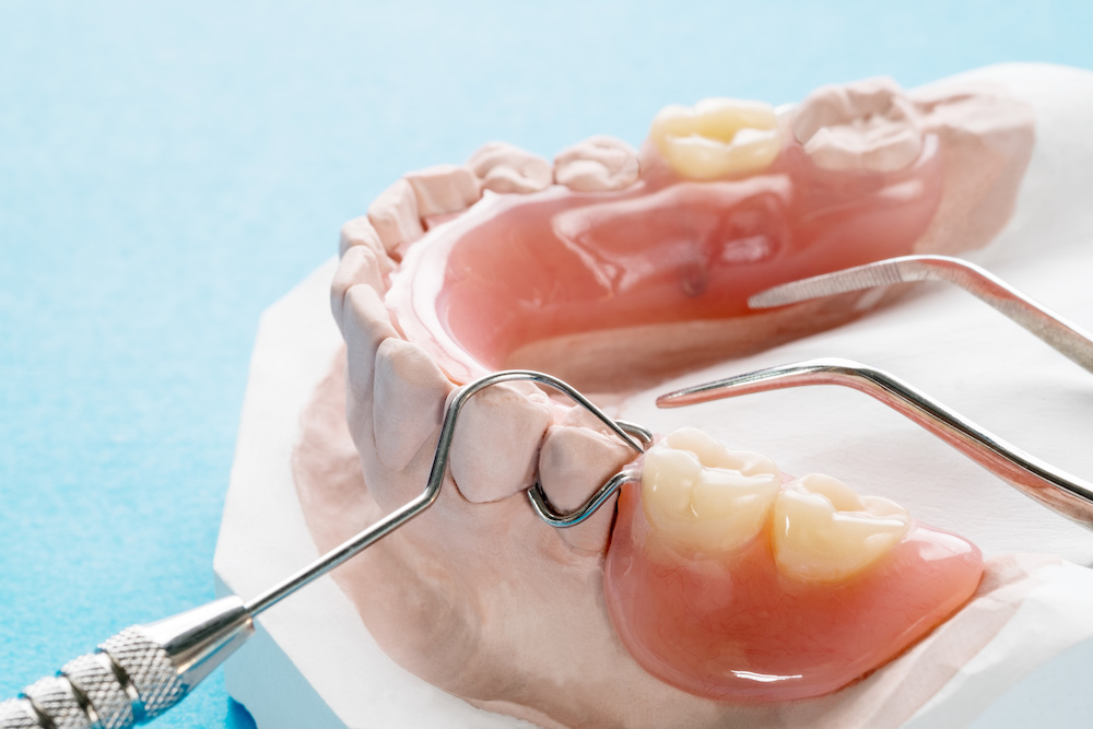 partial denture model