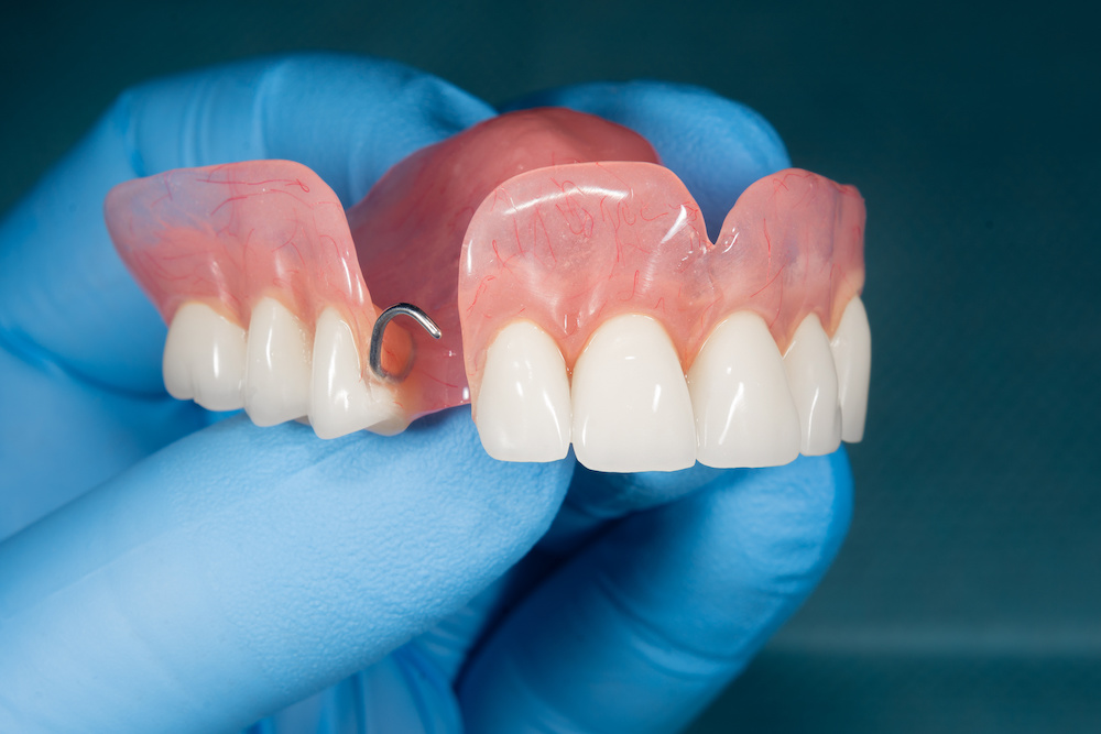 partial upper denture